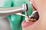 Top 10 Health Benefits of Regular Dental Cleaning
