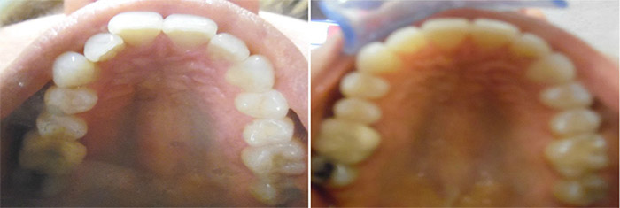 Northpointe  Family Dentistry