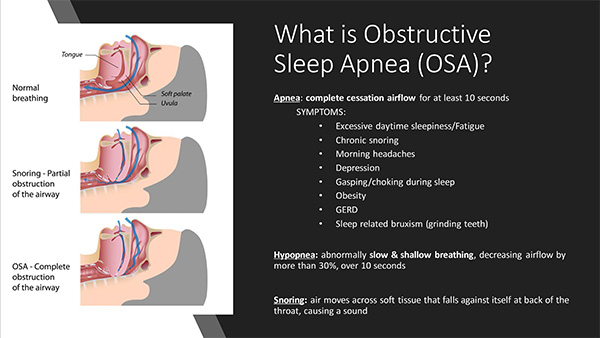 Sleep Apnea