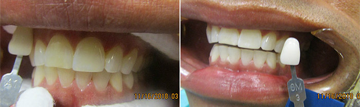 Northpointe  Family Dentistry